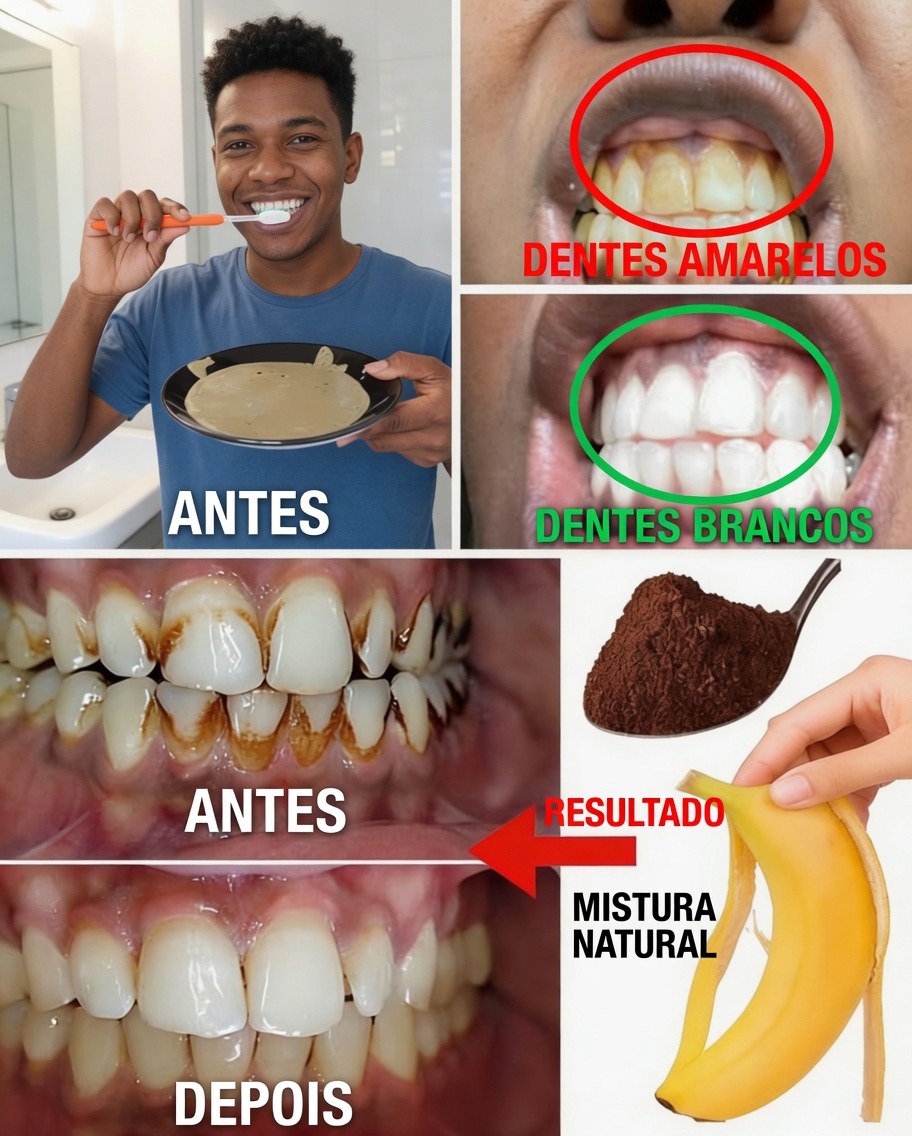 Como Clarear Naturalmente Dentes Amarelados em Casa: Explorando o Método da Casca de Banana, Gengibre e Limão
