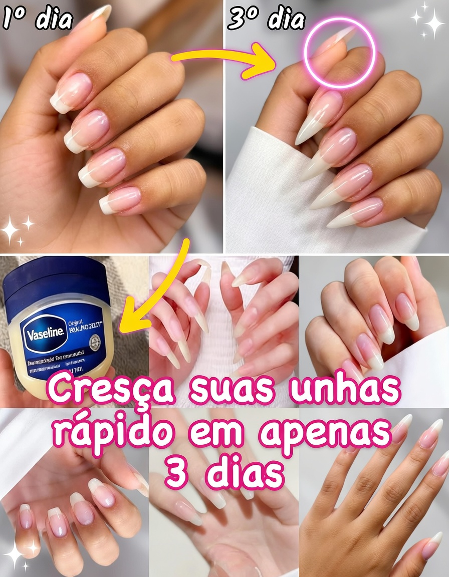 Como fazer suas unhas crescerem visivelmente mais longas e mais fortes naturalmente em apenas 10 dias