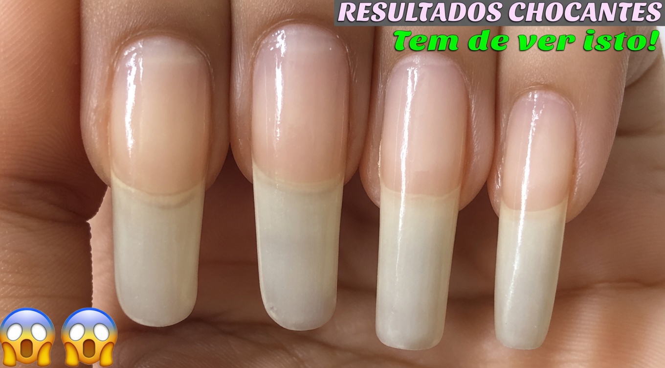 Como fazer suas unhas crescerem visivelmente mais longas e mais fortes naturalmente em apenas 10 dias