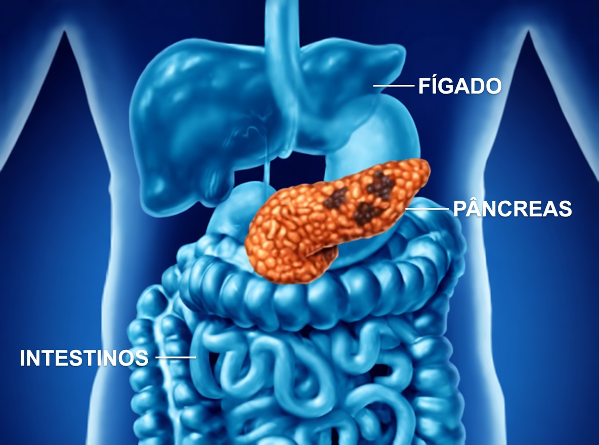 Câncer de pâncreas: dois sintomas que surgiram tarde demais