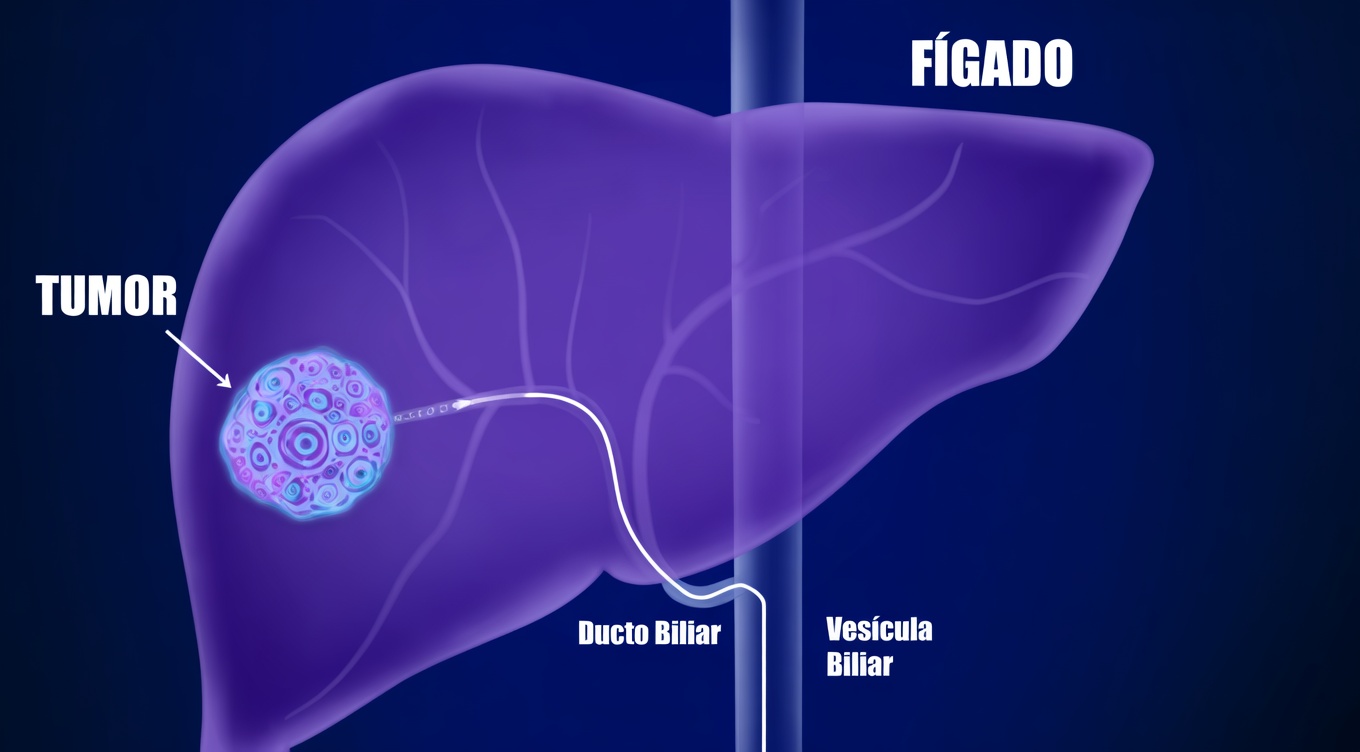 17 Sinais Silenciosos de que Seu Fígado Está Implorando por Cuidado
