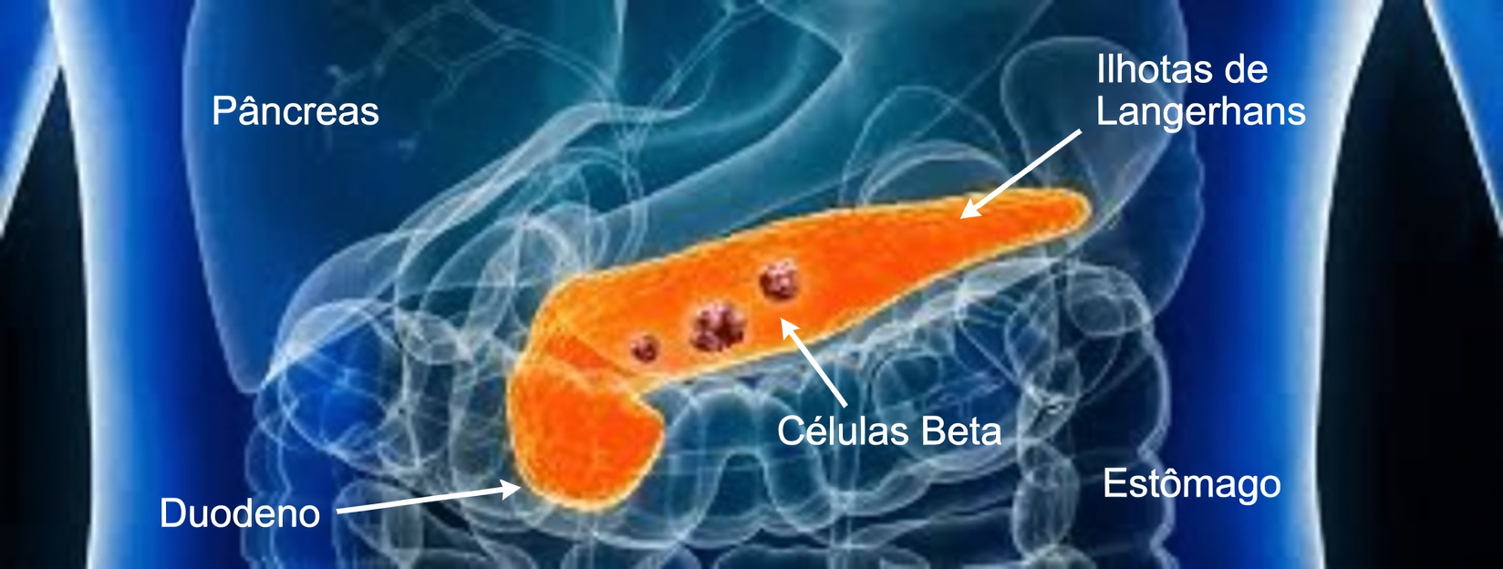 12 Sinais Precoces de Alerta do Câncer de Pâncreas que Você Nunca Deve Ignorar e Como Reconhecê-los