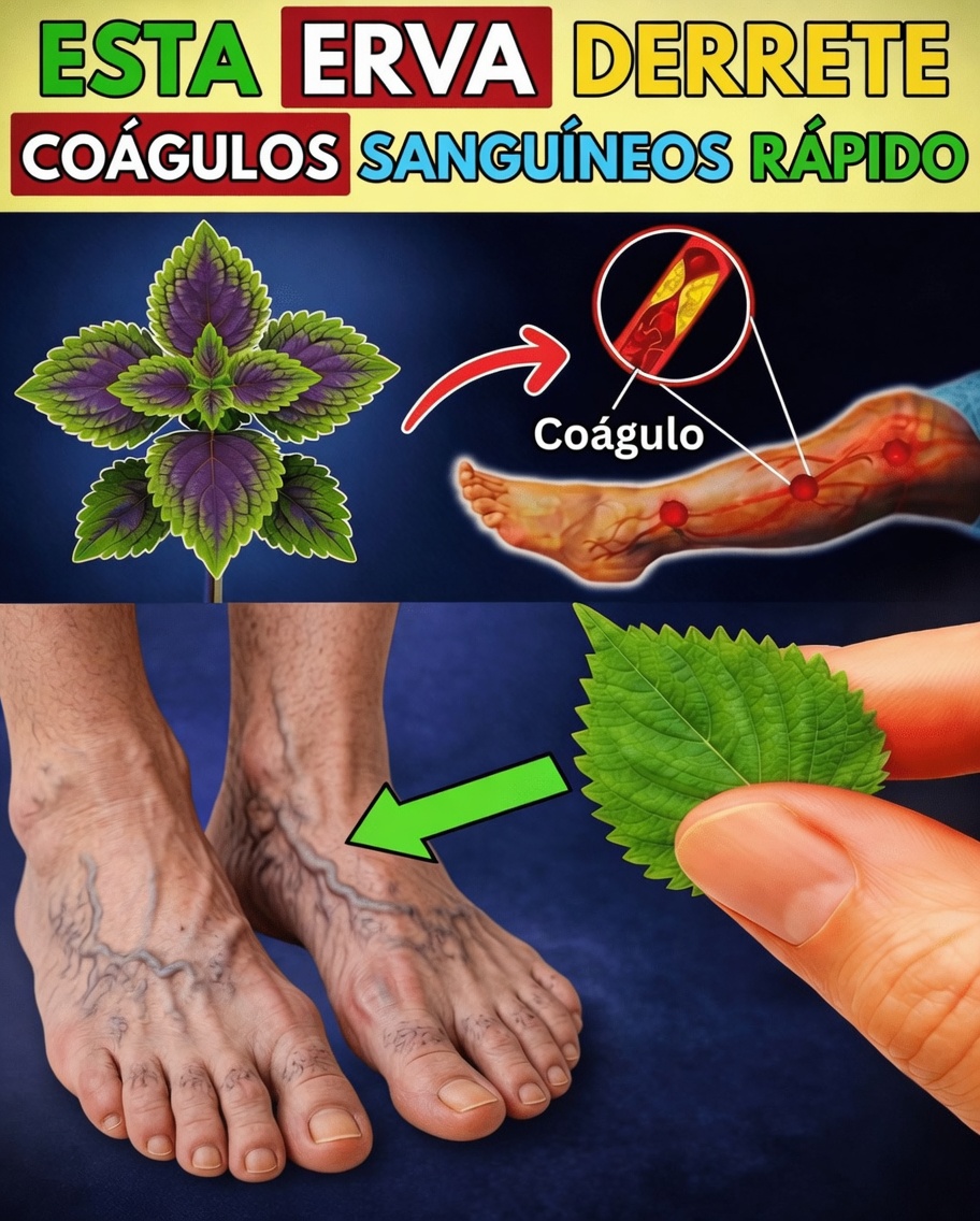 As 6 Ervas Poderosas que Podem Ajudar a Promover uma Circulação Saudável e Reduzir Naturalmente o Risco de Coágulos Sanguíneos