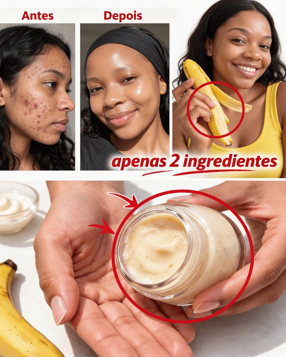 7 Maneiras Naturais de Suavizar Linhas Finas e Aumentar o Brilho da Pele Usando Cascas de Banana