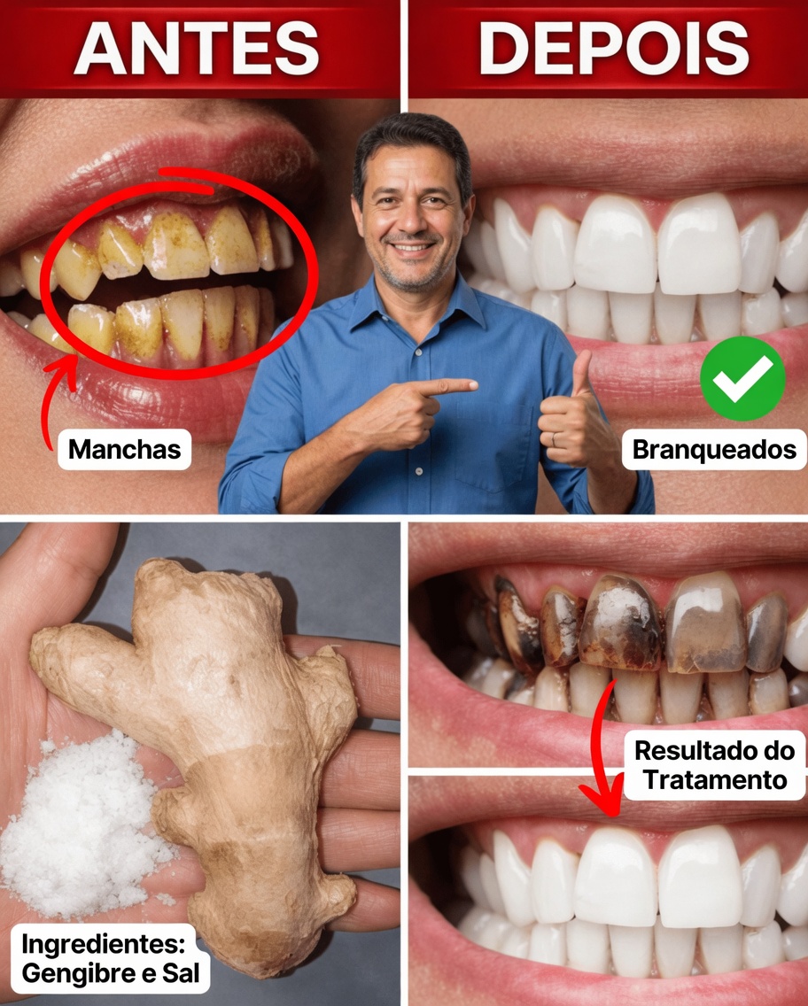 Diga Adeus à Placa Dentária Para Sempre — Os Dentistas Estão Escondendo Isso!