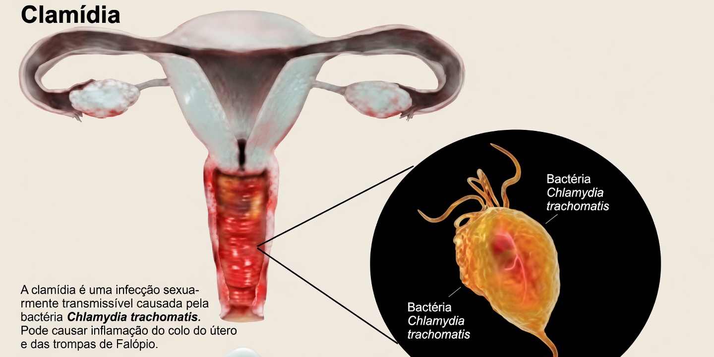 Por que algumas mulheres têm um cheiro de peixe lá embaixo? As 5 principais causas e dicas fáceis de prevenção