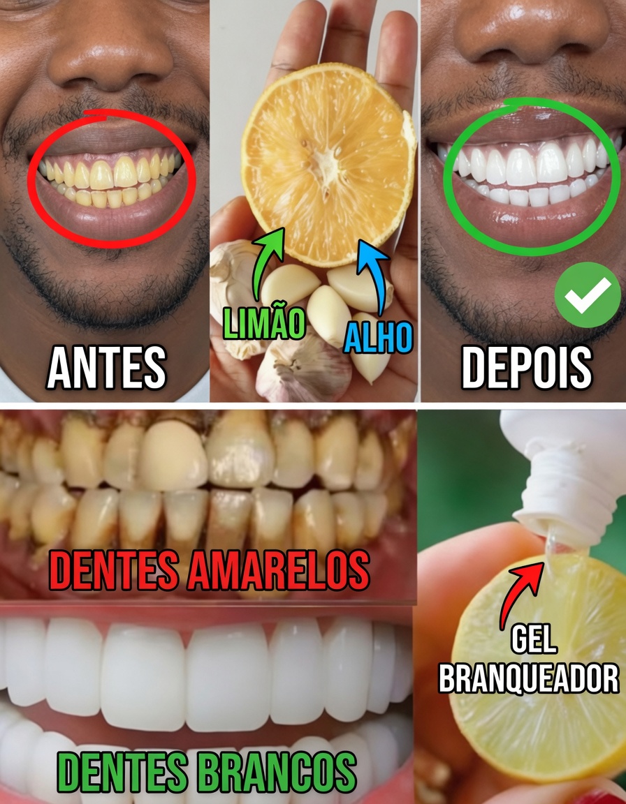Como Clarear Naturalmente os Dentes Amarelados em Casa: o Poderoso Segredo de Banana, Gengibre e Limão de que Milhares Estão Falando