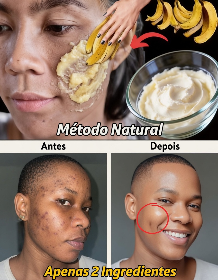 7 Maneiras Naturais de Suavizar Linhas Finas e Aumentar o Brilho da Pele Usando Cascas de Banana