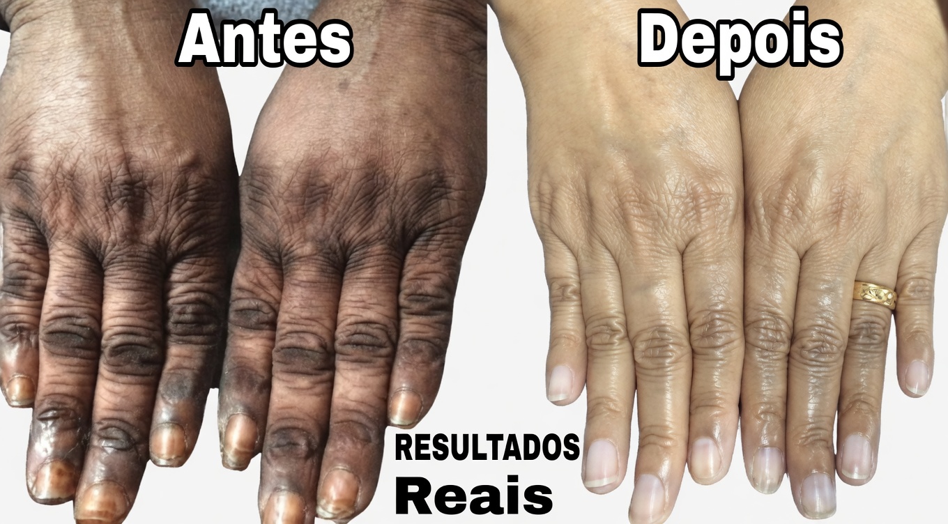 Como mantenho minhas mãos macias, sem rugas, lisas e com aparência mais jovem — a simples máscara para mãos de limão + açúcar + café que realmente funciona