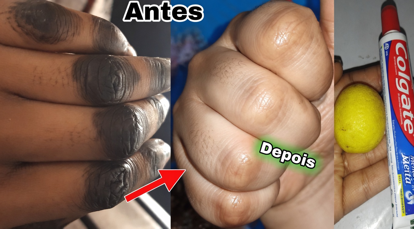 Como mantenho minhas mãos macias, sem rugas, lisas e com aparência mais jovem — a simples máscara para mãos de limão + açúcar + café que realmente funciona