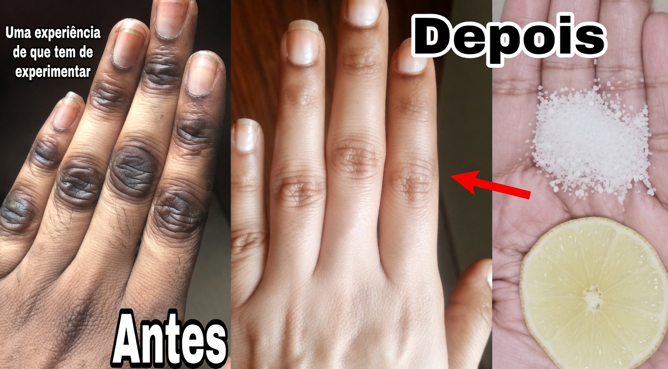 Como mantenho minhas mãos macias, sem rugas, lisas e com aparência mais jovem — a simples máscara para mãos de limão + açúcar + café que realmente funciona