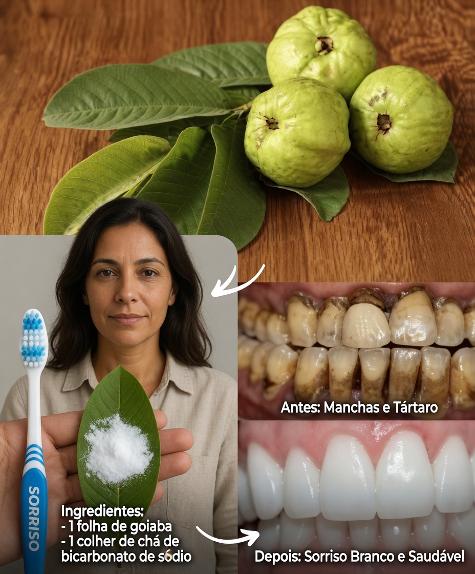 Top 3 Maneiras de Tratar a Cárie Dentária com Folhas de Goiabeira – Simples e Econômico