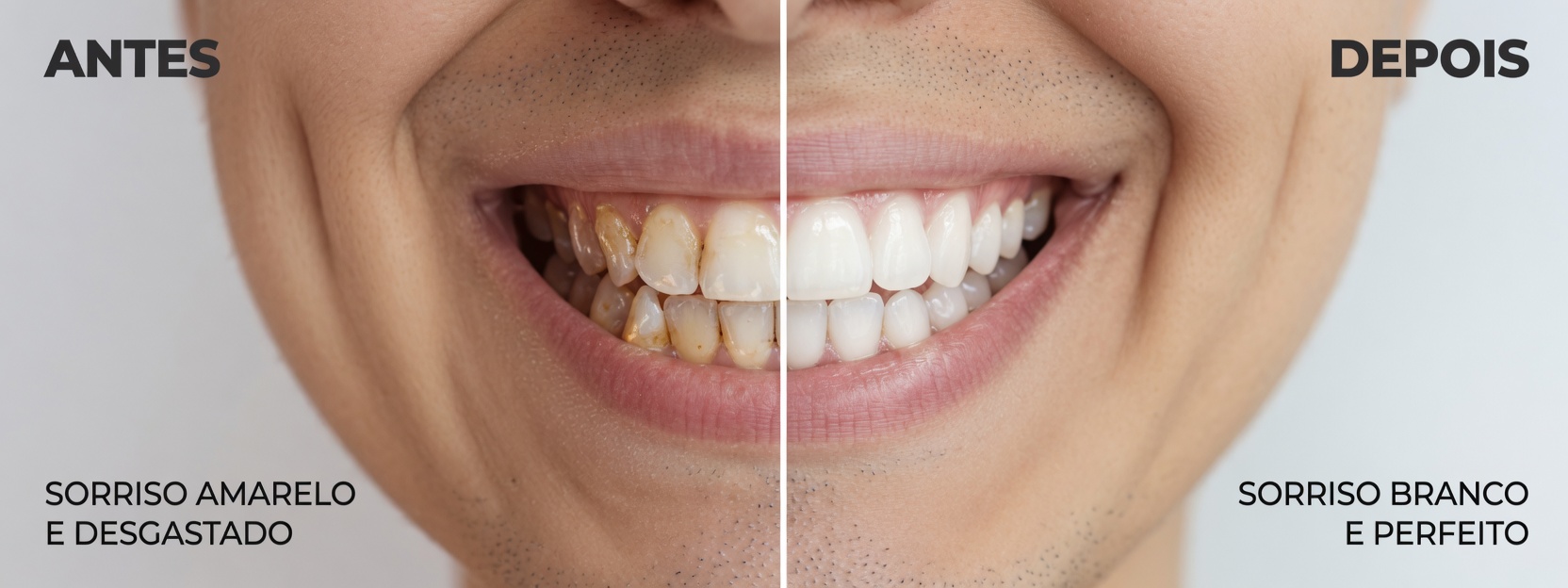 Como Clarear Naturalmente o Seu Sorriso com Folhas de Goiabeira: Um Remédio Caseiro Suave