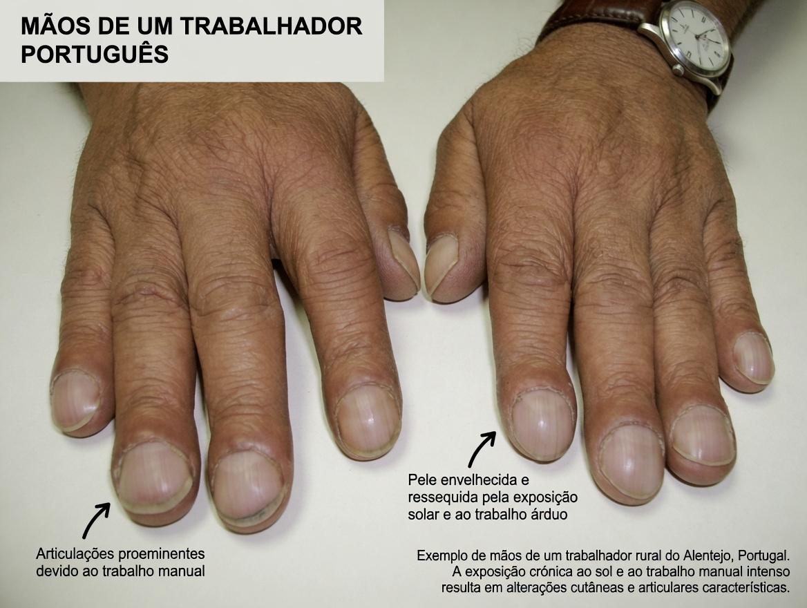 8 Mudanças Imperceptíveis no Seu Corpo que Podem Ser um Alerta de Problemas de Saúde