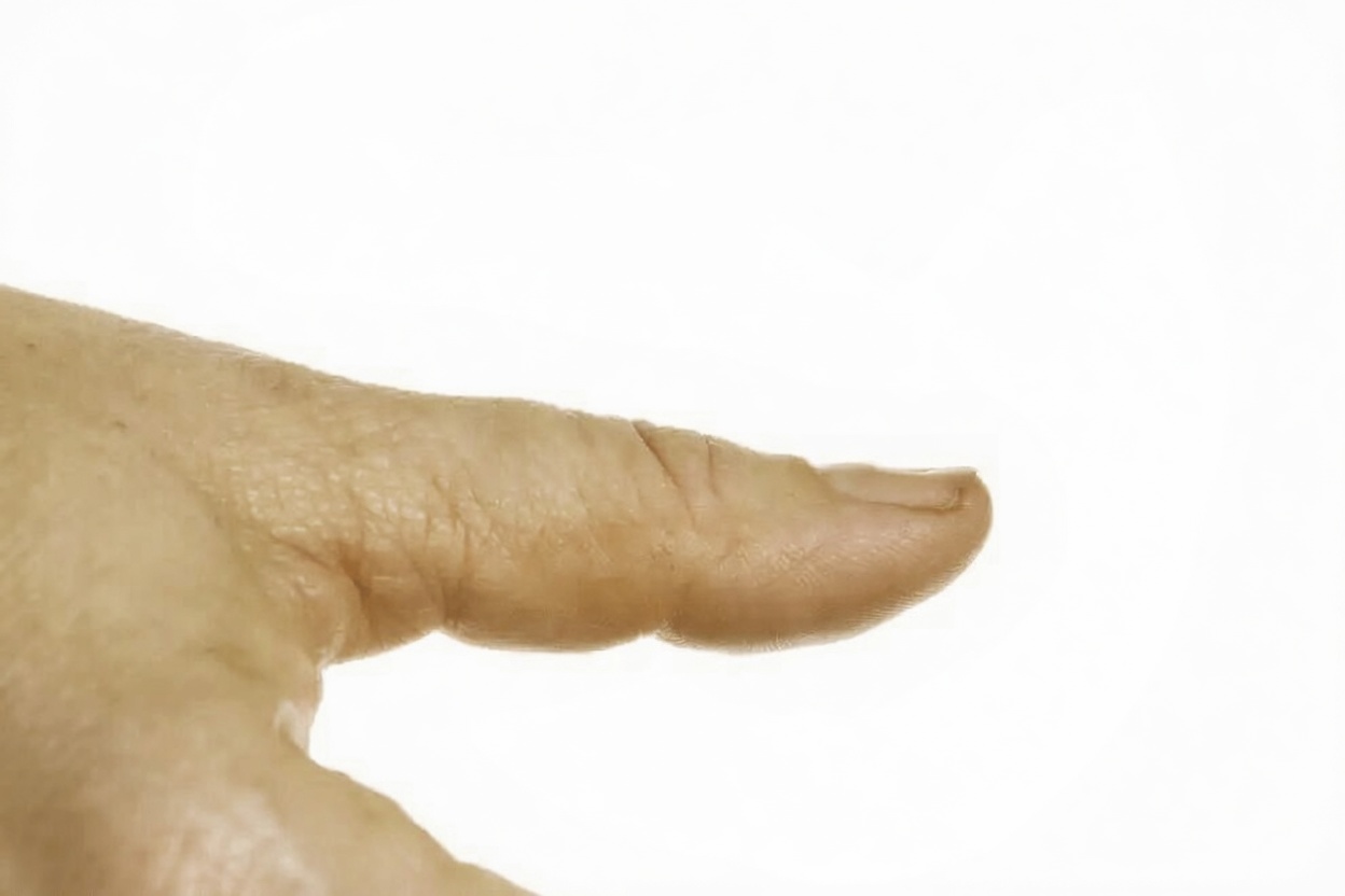 8 Mudanças Imperceptíveis no Seu Corpo que Podem Ser um Alerta de Problemas de Saúde