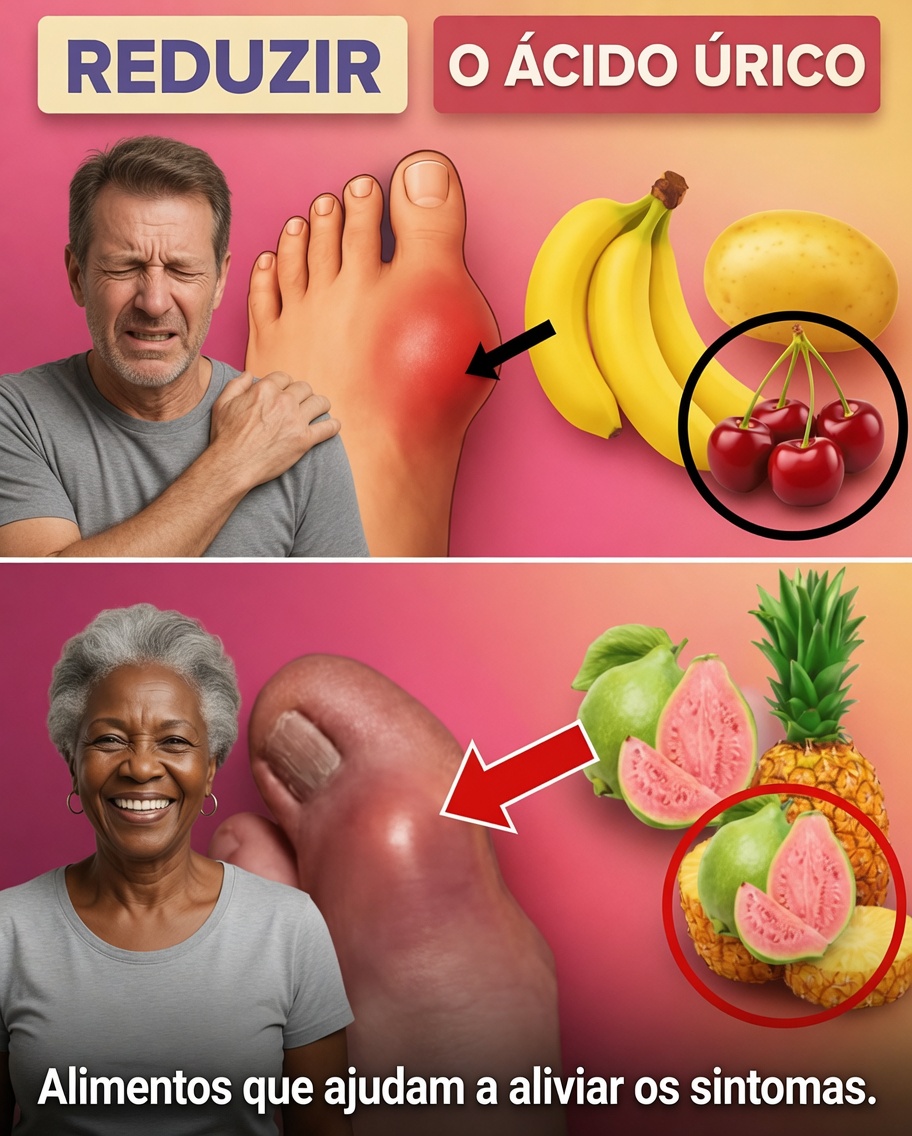 11 Alimentos Comprovados por Pesquisas que Podem Ajudar a Reduzir Naturalmente Seus Níveis de Ácido Úrico