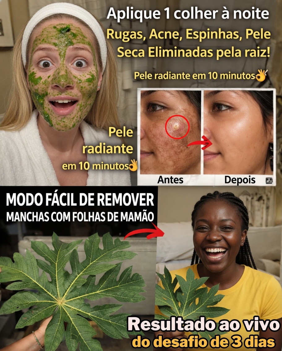 O surpreendente remédio com folha de mamão que está ajudando milhares a reduzir naturalmente o melasma, a hiperpigmentação e a descoloração