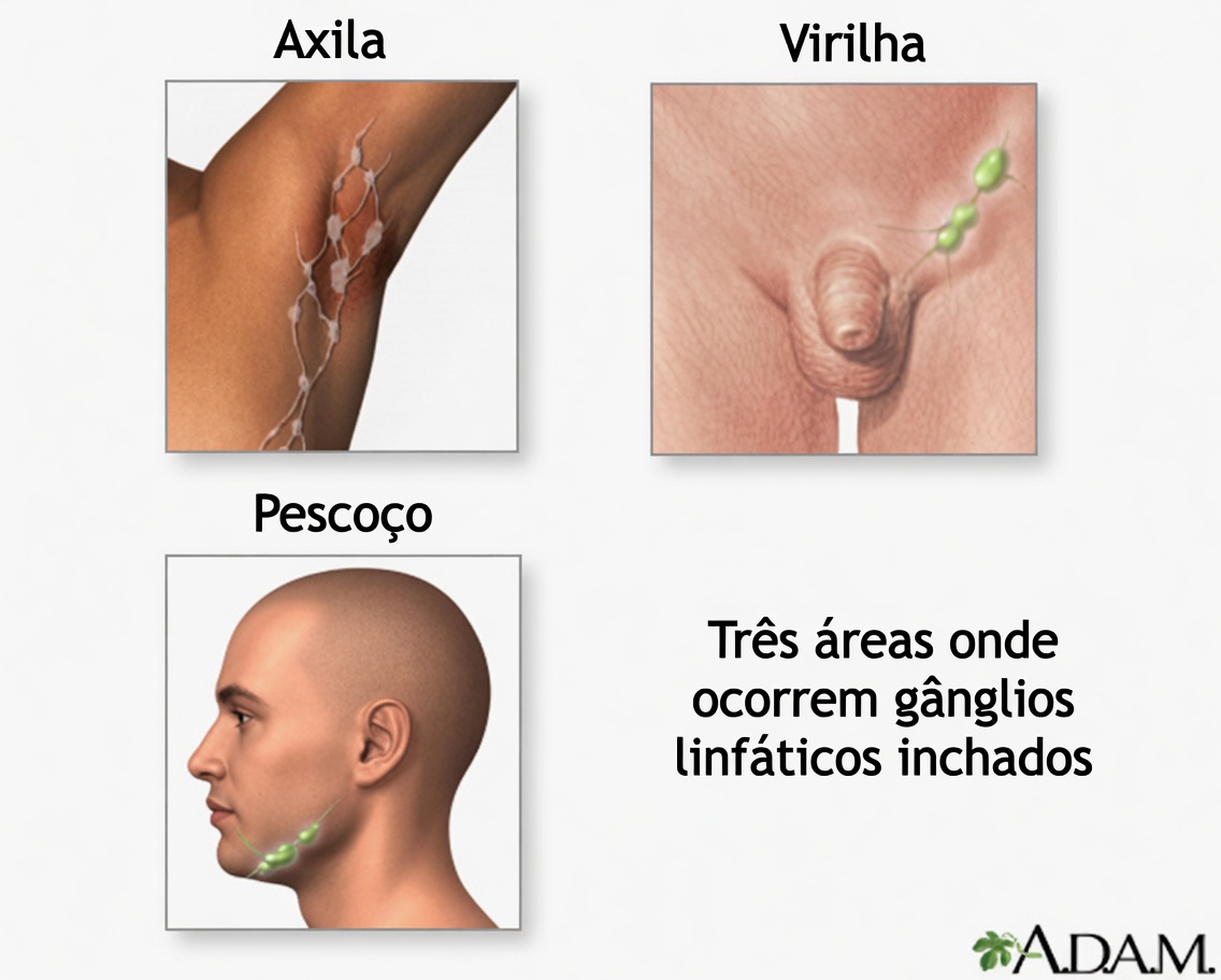 14 Sinais de Alerta de Câncer que Muitas Mulheres Ignoram – Não Espere Até Ser Tarde Demais