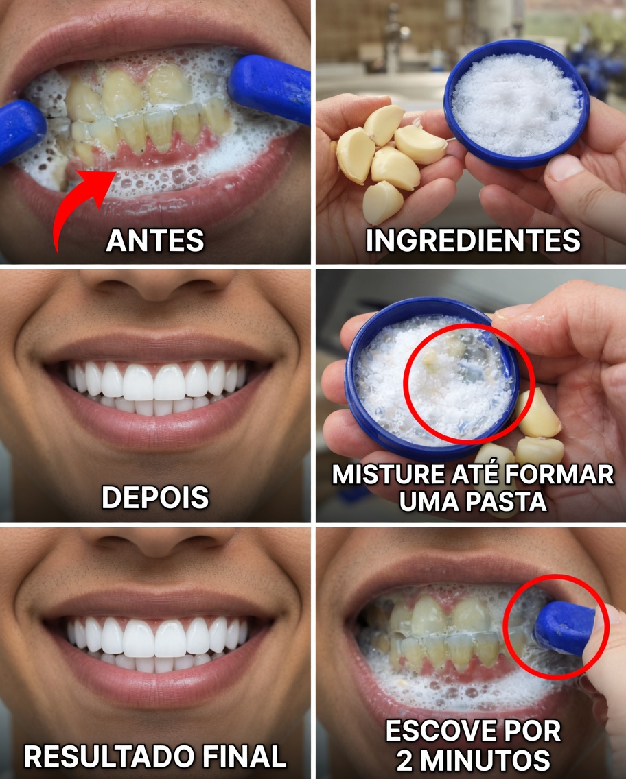 Ilumine Seu Sorriso Rapidamente: Truques Simples de Clareamento Dental em Casa em Minutos