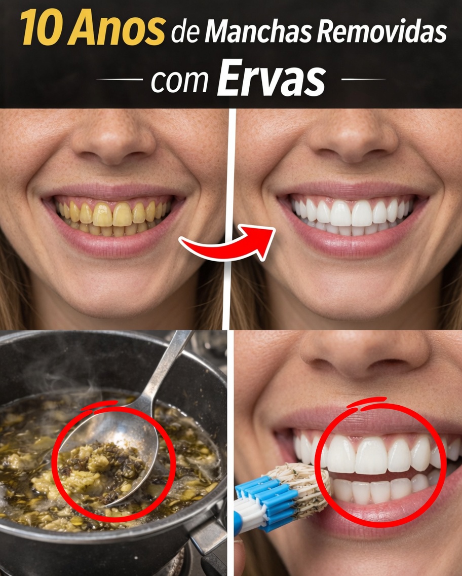O seu café da manhã está manchando os seus dentes? Veja o que você pode fazer a respeito