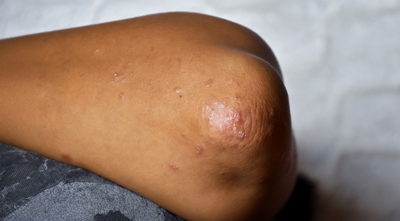 Truque de Vaselina + Sal: O Hack à Moda Antiga para uma Pele Mais Firme e Lisa que Está Voltando a Viralizar Discretamente