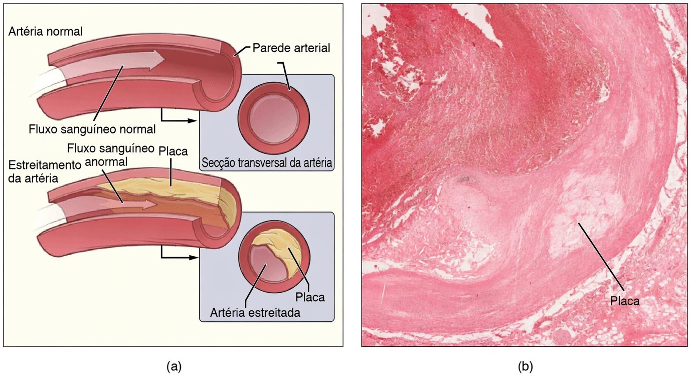 Misture Estes 3 Itens do Dia a Dia Antes de Dormir – Veja Suas Artérias Amolecerem Enquanto Você Dorme