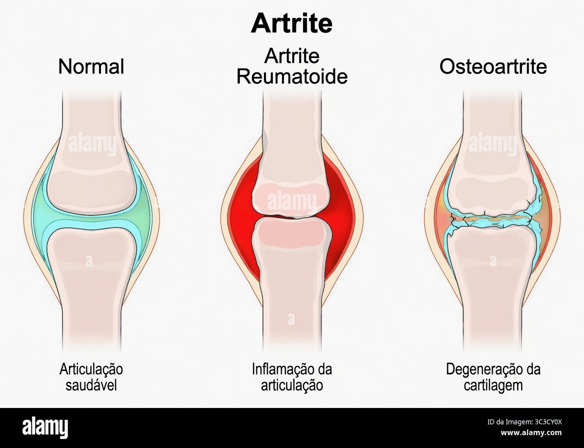 Alívio Rápido! Isso Vai Aliviar a Dor nas Articulações Naturalmente