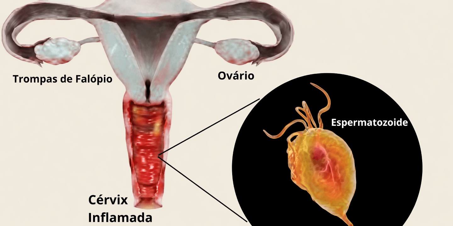 Por que a vag.ina tem cheiro azedo? 4 motivos reais que toda mulher deveria saber