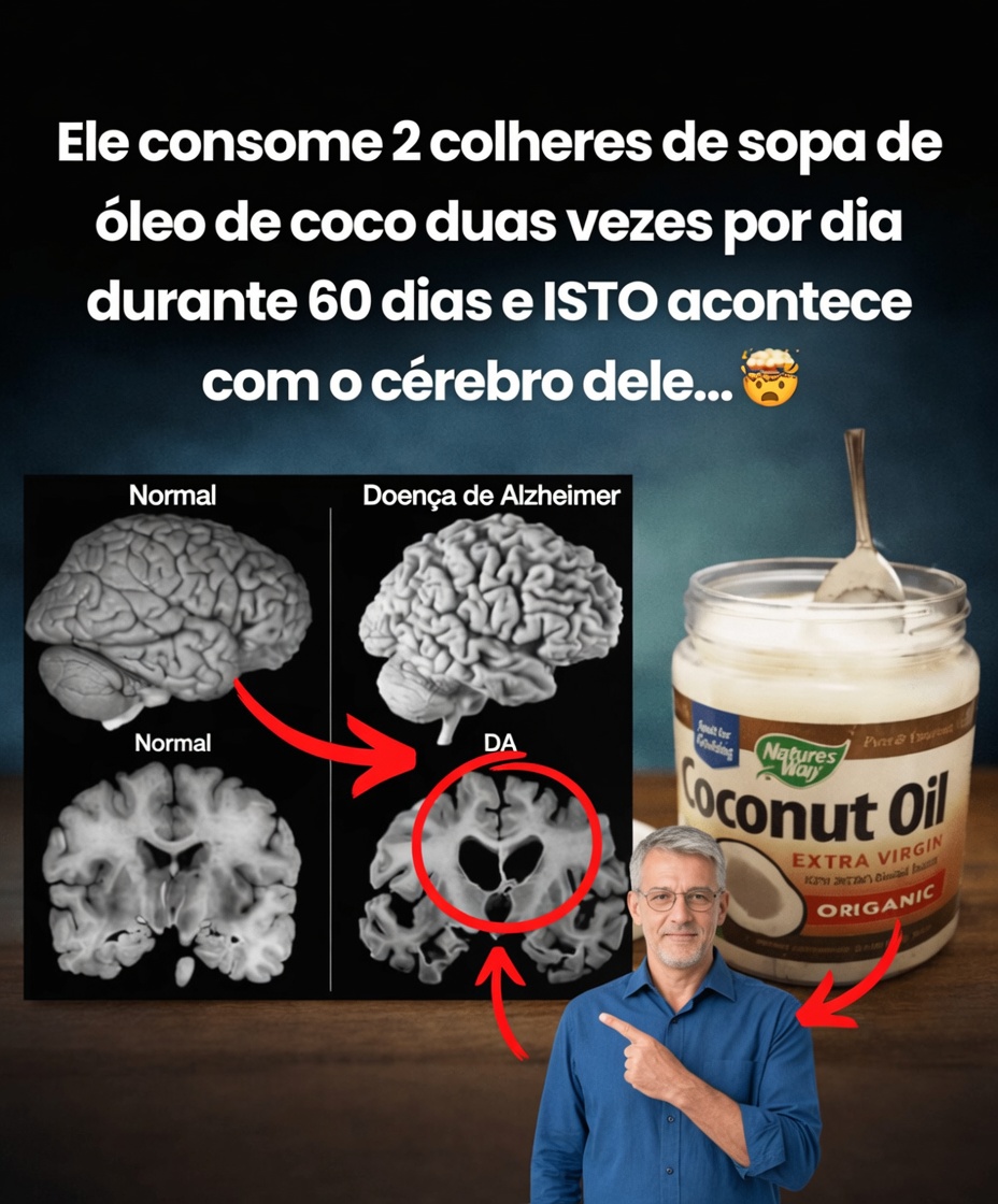 Ele come 2 colheres de sopa de óleo de coco duas vezes por dia durante 60 dias e isso acontece com o cérebro dele!