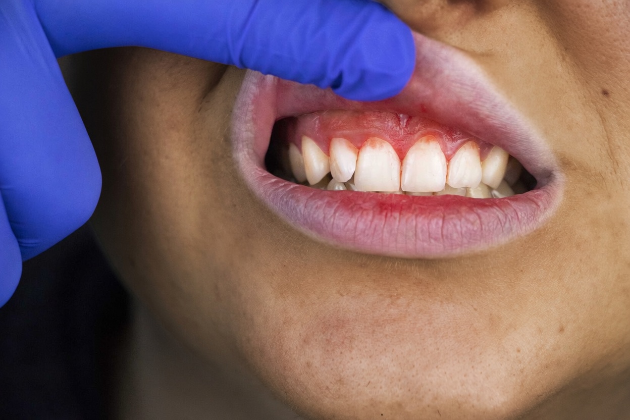 7 Sinais Silenciosos do Corpo que Podem Revelar Deficiências Ocultas de Nutrientes Após os 60