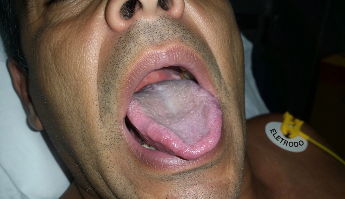 O que a cor da sua língua revela sobre seus hábitos de saúde