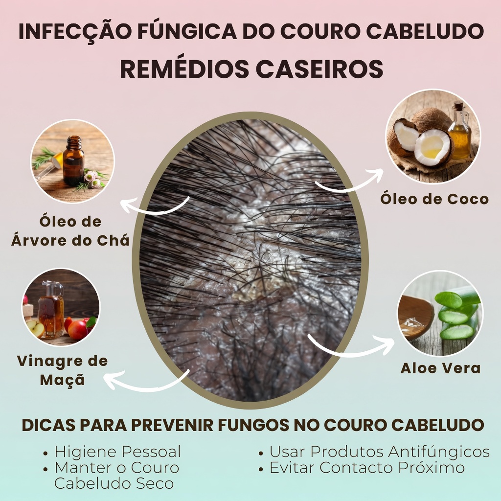Anéis Vermelhos no Couro Cabeludo do Seu Filho com Queda de Cabelo? Orientações Essenciais para Pais