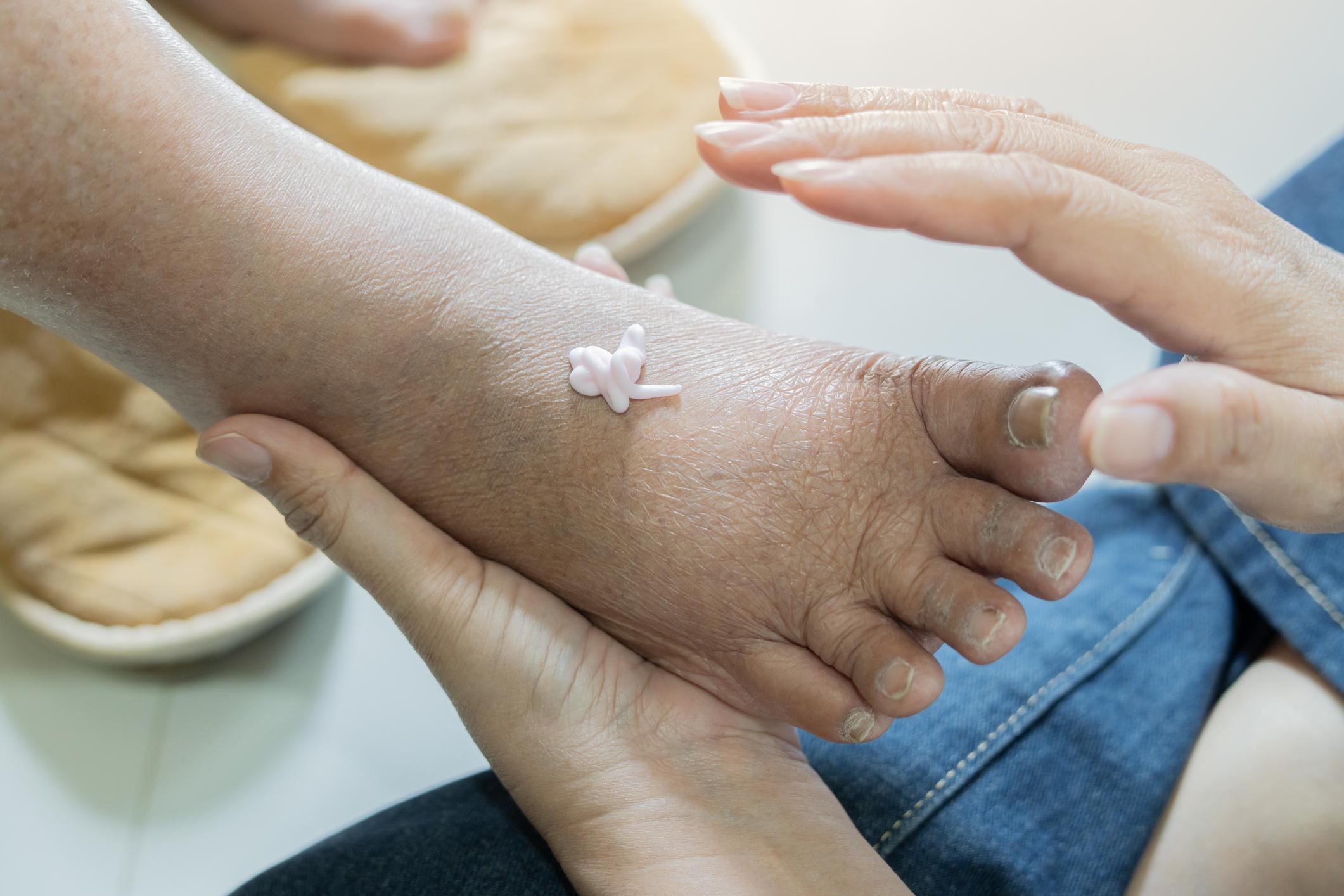 Idosos: Seus pés estão sofrendo silenciosamente? Experimente esta rotina com vinagre de maçã