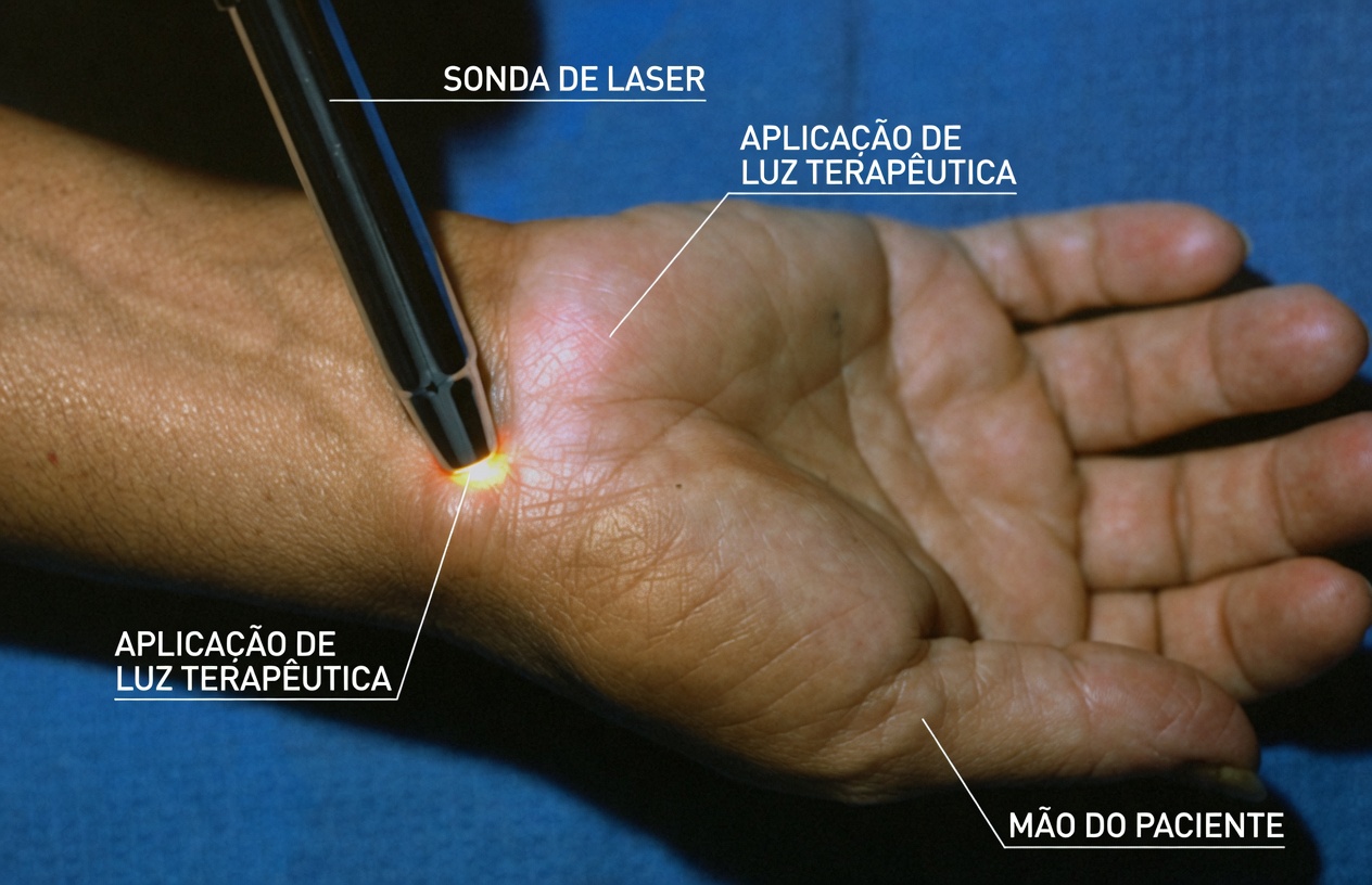 Um Caroço Estranho no Pulso da Noite para o Dia? O Que Pessoas Idosas Devem Saber