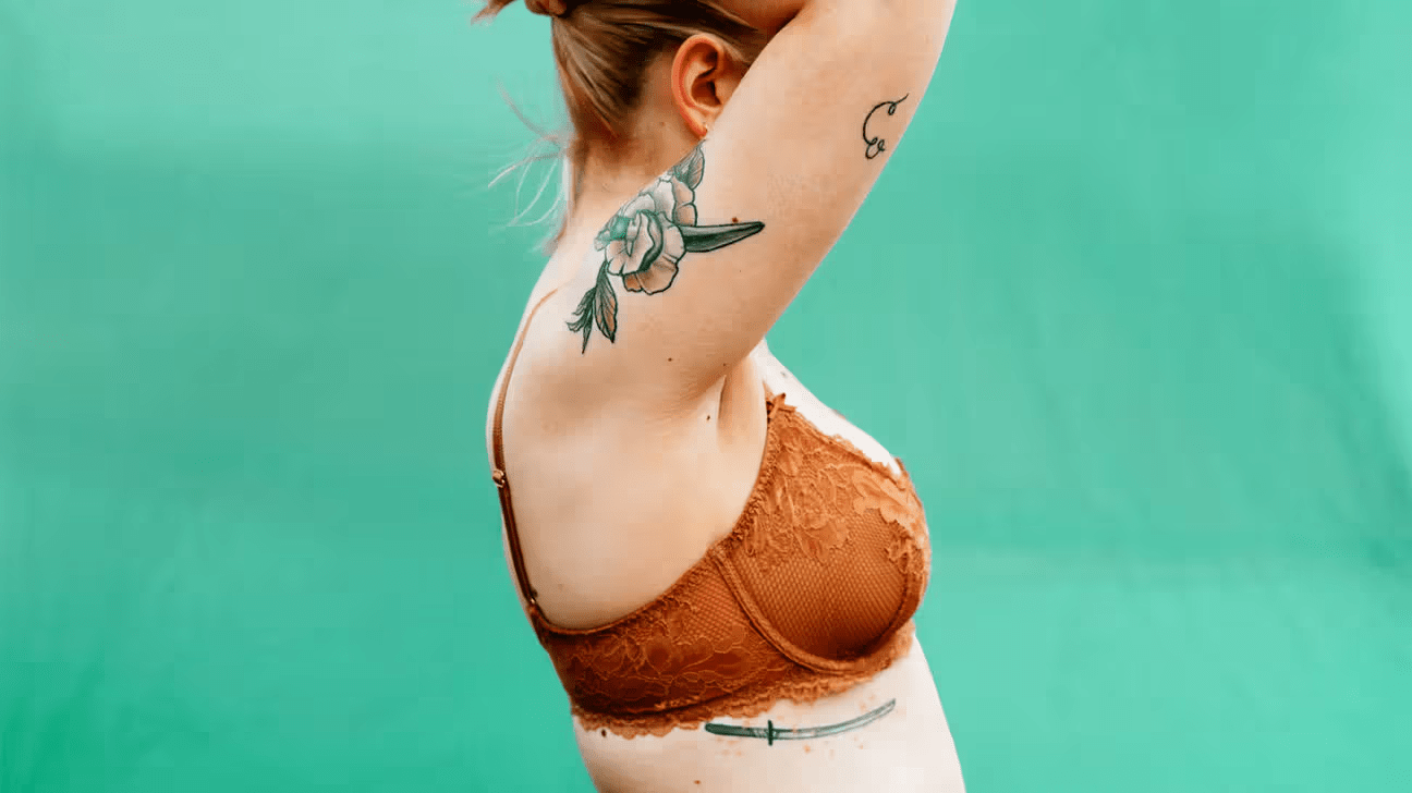 O que fazer para uma erupção cutânea com coceira sob os seios neste inverno quando seu médico não está disponível