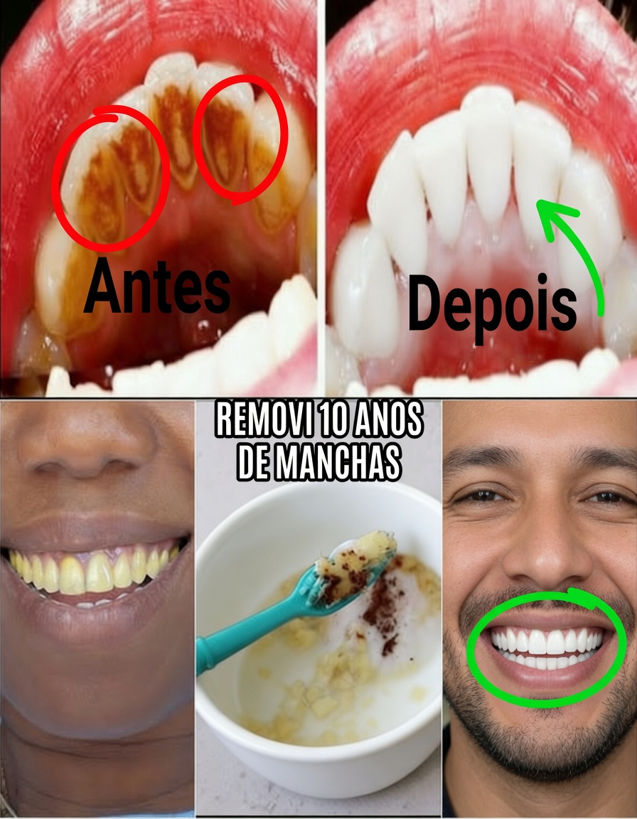 Branqueie os dentes em 2 minutos: o segredo da casca de banana que choca todo mundo