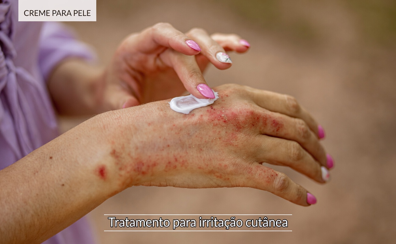 Sinais de Alerta de Dermatite nas Mãos: Hábitos Essenciais e Dicas de Prevenção para Proteger a Barreira Cutânea