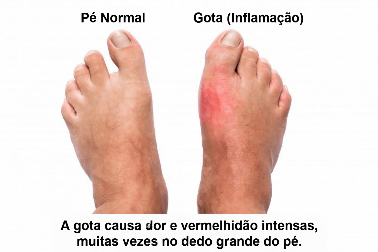 15 Sinais Precoces de Alerta de Diabetes que Você Deve Reconhecer para Melhor Consciência sobre a Saúde