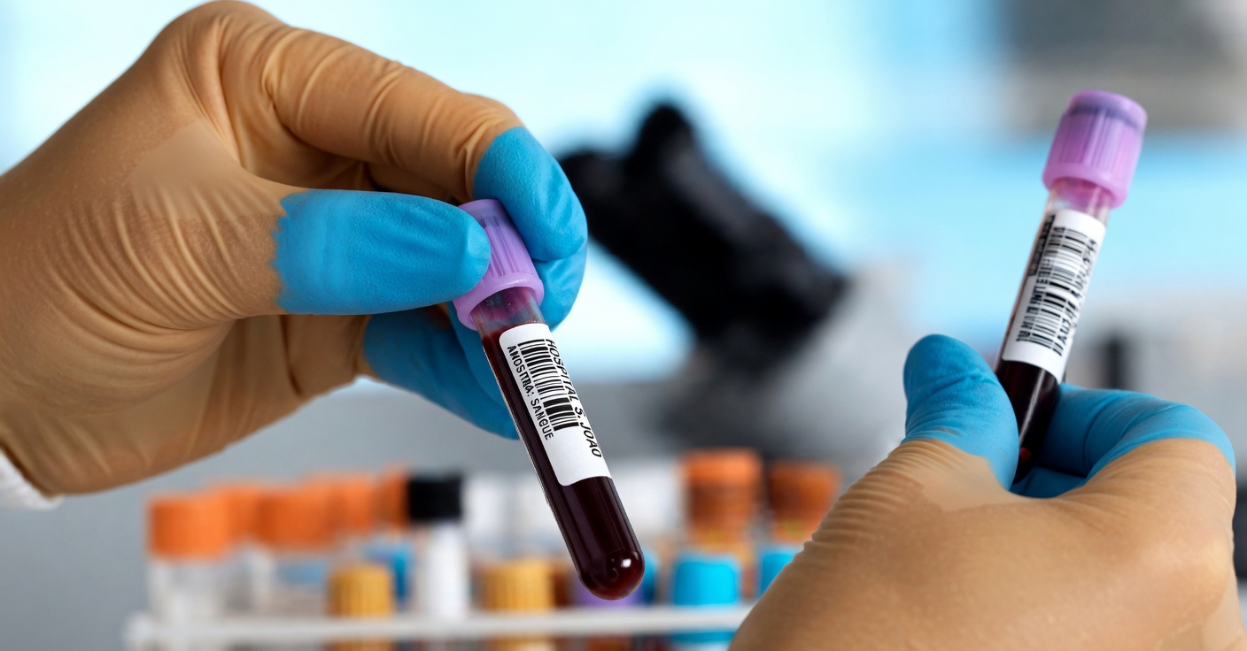 Médicos revelam: o tipo sanguíneo O parece estar associado ao menor risco geral de câncer em vários estudos