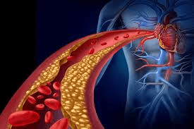 Médicos revelam: o tipo sanguíneo O parece estar associado ao menor risco geral de câncer em vários estudos