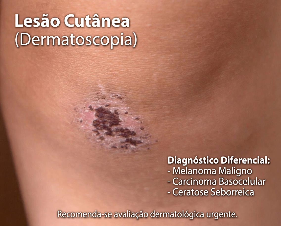 Seu corpo pode estar implorando por mais vitamina D? Descubra estes 8 sinais estranhos