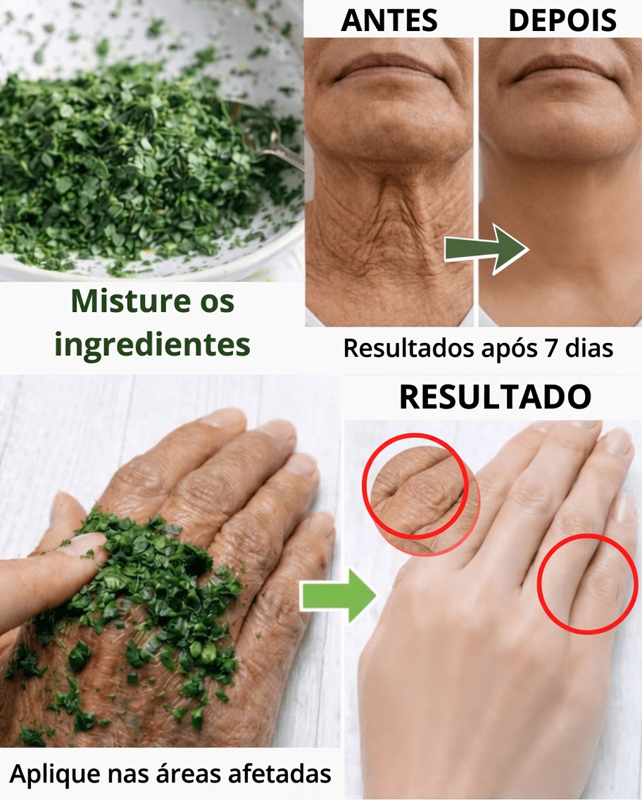 Eu mesmo fiz e ninguém acreditou em mim, esta máscara ajuda você a eliminar rugas e manchas