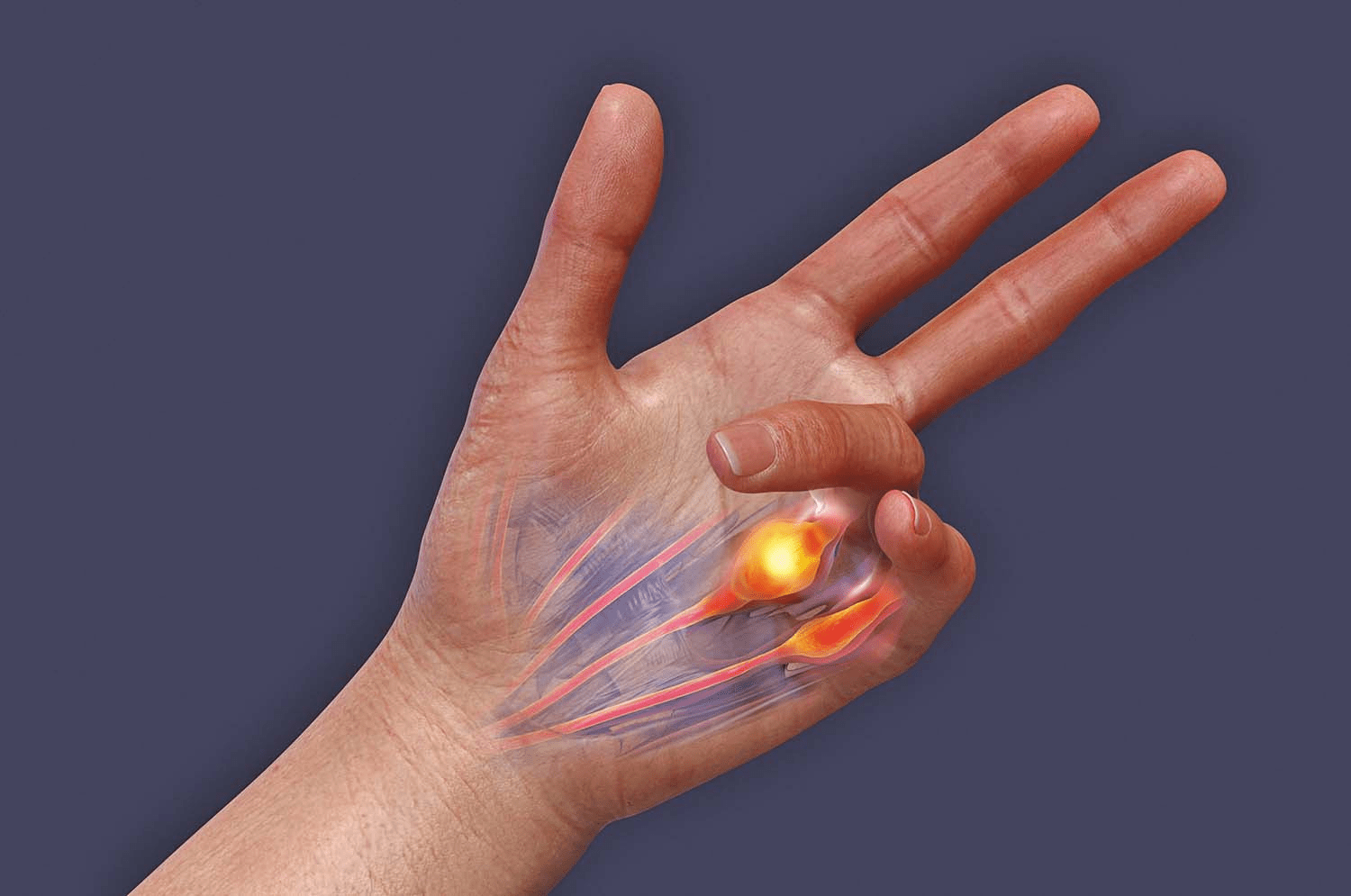 Primeiro sintoma de ELA de Eric Dane: o que a fraqueza inicial na mão dele pode nos ensinar sobre mudanças neurológicas sutis