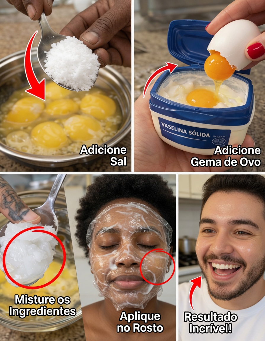 Chega de rugas aos 65! A máscara noturna de gema de ovo e vaselina que deixou o rosto da minha mãe tão preenchido que as amigas acharam que ela fez preenchimento