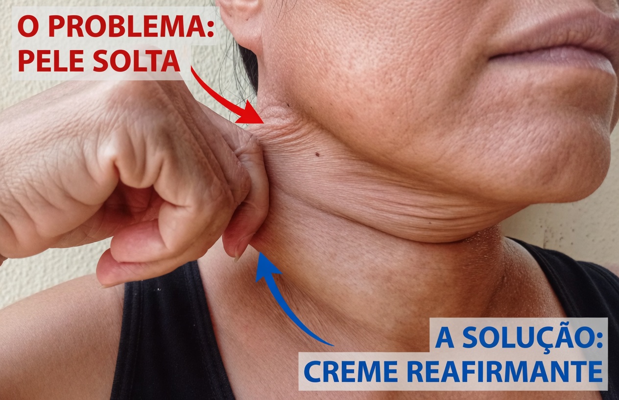 Por que a pele do seu pescoço começa a ficar flácida? Entenda as causas e hábitos simples para ajudar a manter a pele com aparência mais firme