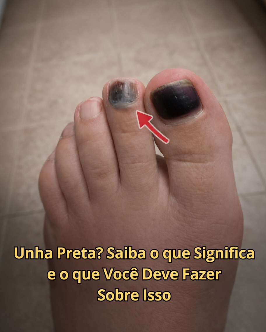O que a sua unha do pé preta pode estar tentando dizer: causas comuns e hábitos diários inteligentes a considerar