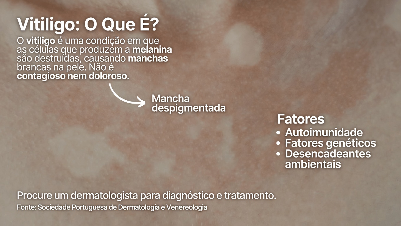 Por que aparecem manchas brancas na sua pele? Causas comuns e o que saber