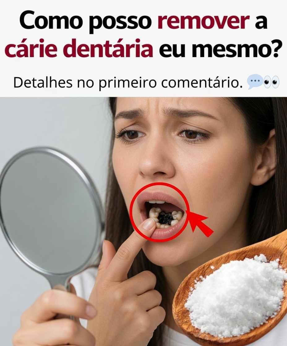 Como posso remover a cárie dentária sozinho? A verdade sincera (e o que realmente funciona)