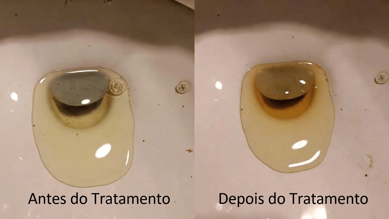 O Que a Cor da Sua Urina Diz Sobre Sua Hidratação e Saúde: Um Guia Diário Simples