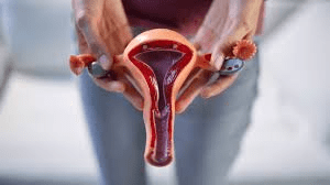 Tudo o que você precisa saber sobre corrimento vaginal: um guia completo sobre o que é normal e quando prestar atenção